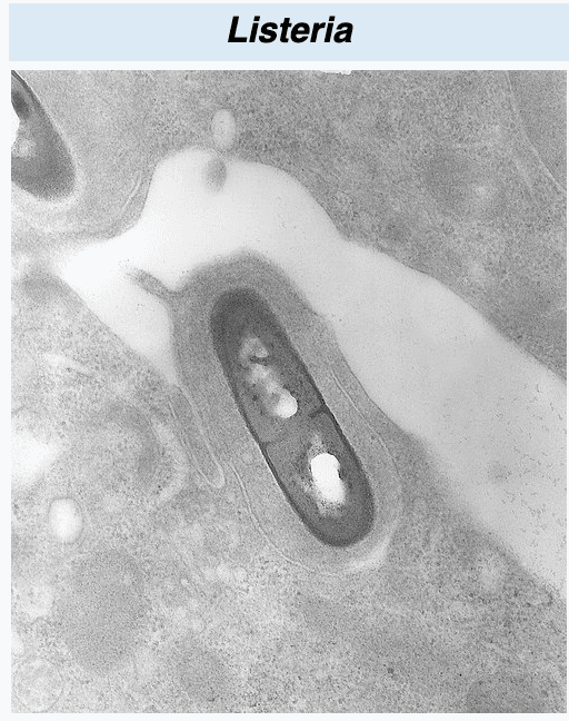 Listeria (Mikroskop)